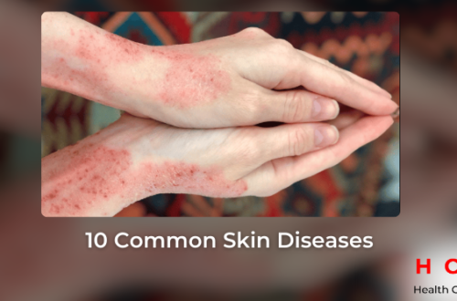 10 Common Skin Diseases: