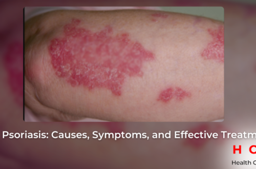 Psoriasis