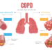 Chronic Obstructive Pulmonary Disease (COPD)