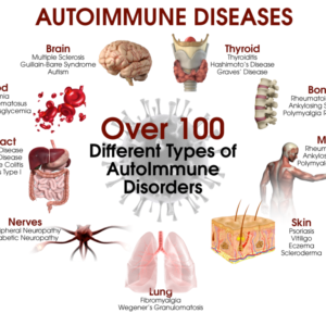 Autoimmune Diseases